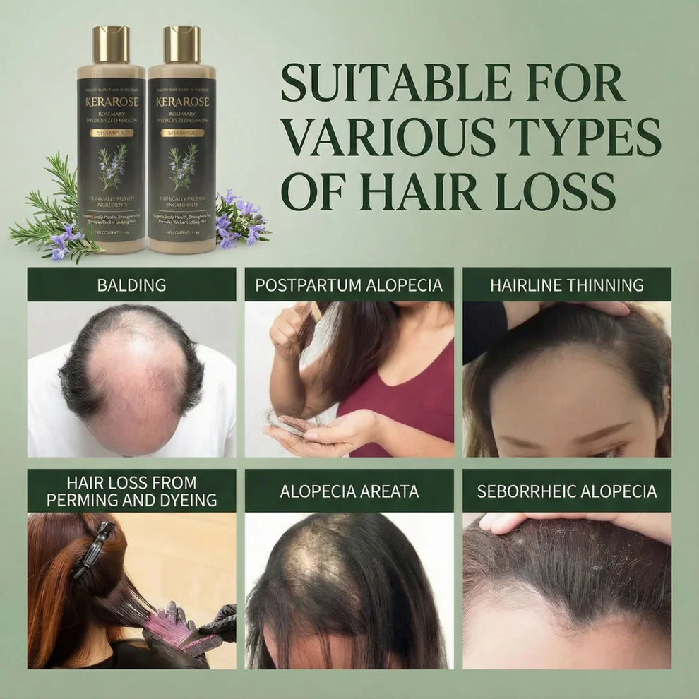 Kerarose Rosemary Shampoo For Hair Growth ( Buy 1 Get 1 Free 🔥) .